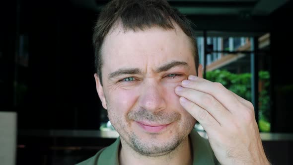 Man with Eye Bruise Shiner Feeling Pain Touching Eyelid Inflammation By Hand alt