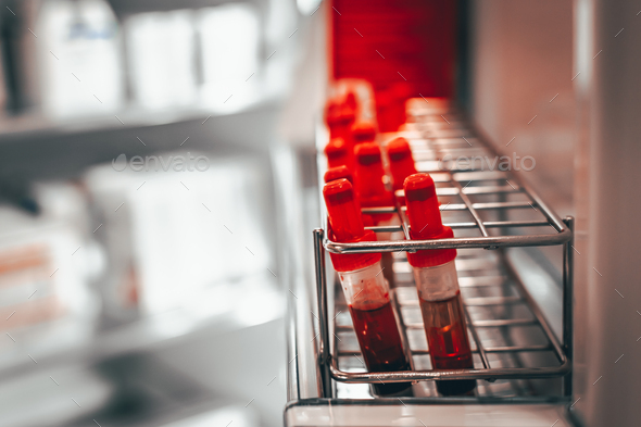 Test tubes with blood, for the control of antibodies, in a refrigerator of an intensive care unit.
