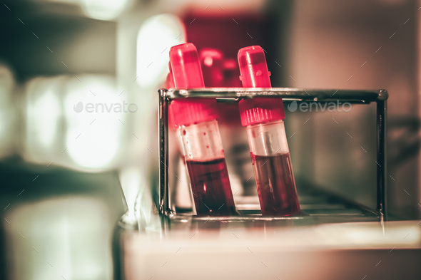 Test tubes with blood, for the control of antibodies, in a refrigerator of an intensive care unit.