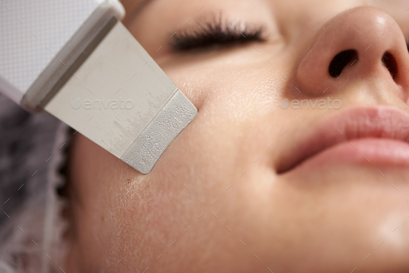 Closeup of an ultrasound facial peeling performed to young woman with false lashes