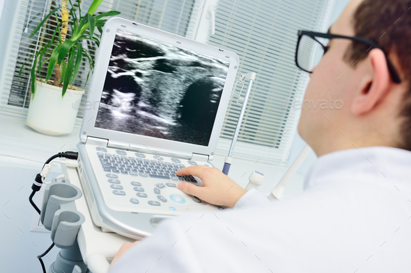 doctor examines the result of an ultrasound examination of the thyroid gland on the monitor.