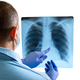Doctor examining x-ray of chest and ribs and indicates health problems. - PhotoDune Item for Sale