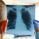Doctor reading a chest x-ray in a hospital, close-up. - PhotoDune Item for Sale