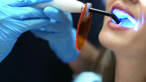 Dentist Using Ultraviolet Lamp alt
