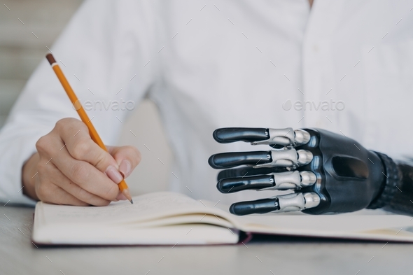 Cyber arm and healthy limb on the notebook. Woman with bionic prosthesis is studying remotely.