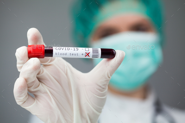 Doctor in green holding test tube with Coronavirus patient blood sample