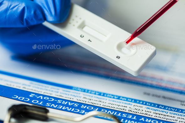 Medical laboratory technician placing blood sample specimen on quick rapid diagnostic test