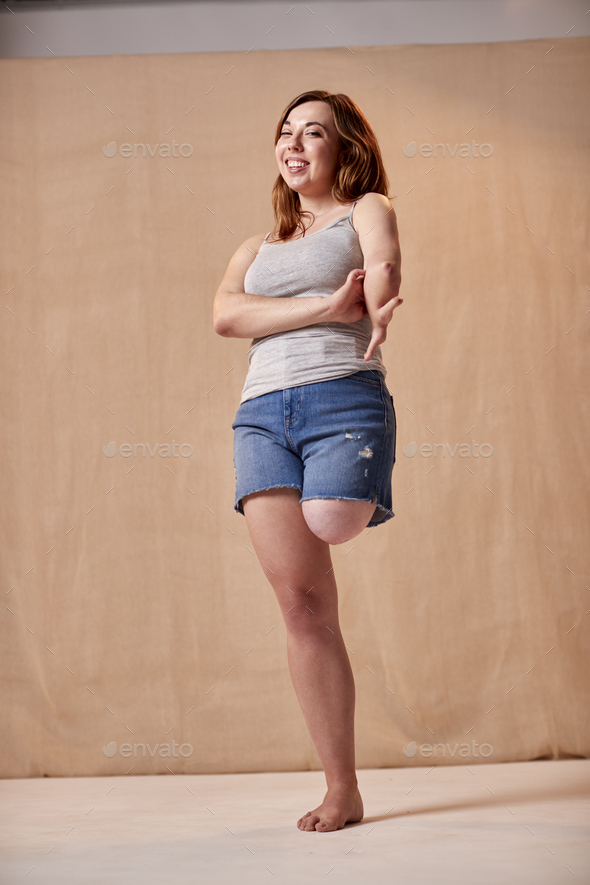 Studio Portrait Shot Of Body Positive Woman With Prosthetic Leg