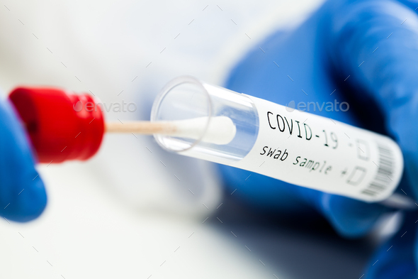 rt-PCR COVID-19 virus disease diagnostic test
