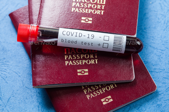 Several passports and test tube with blood sample - Stock Photo - Images