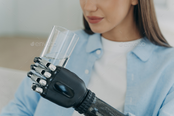 High technology robotic arm prosthesis. Handicapped european girl is holding glass of water.