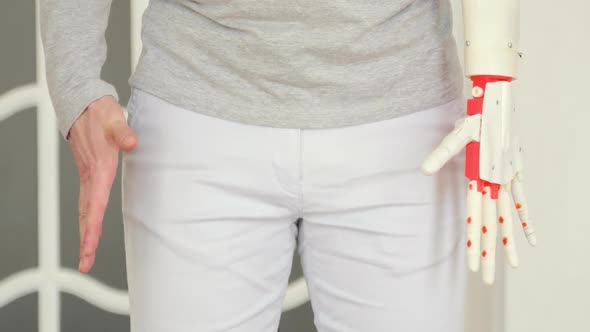 Patient Man Is Testing His New Robotic Prosthetic Hand Trying Simultaneously Moving Two Hands alt