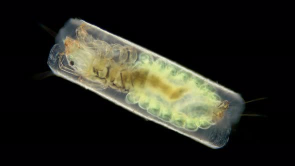 Trichoptera larva under a microscope, family Hydroptilidae alt