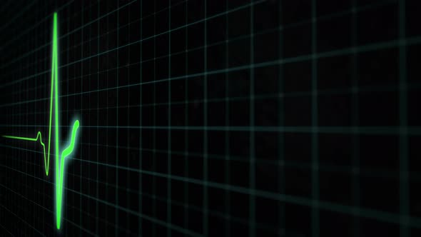 Heart Rate Chart a Medical Screen of Healthy Heart Rate in Closeup alt