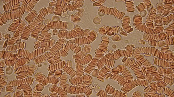 Blood Under a Microscope, Adhering Red Blood Cells in Clotted Blood, They Are Also Called the Effect alt