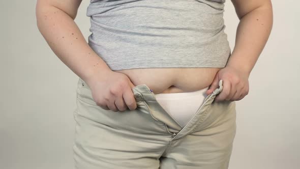 Overweight Female Trying to Button Trousers Before Camera, Obesity, Plus Size alt