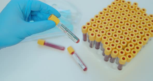 Covid-19 Pandemic. Diagnostic Testing. Technician in Protective Gloves Checking Blood Sample in Tube alt