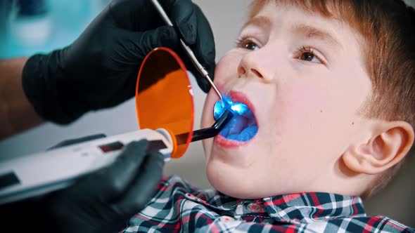 A Little Boy Having His Tooth Done - Putting the Photopolymer Lamp in the Mouth and Turning It on alt