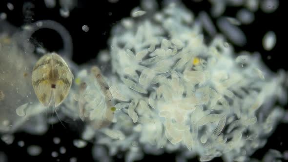 Colony infusorium Ciliophora of the genus Paramecium under a microscope, order Peniculida alt