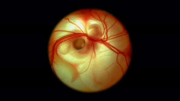 Heartbeat and Movement of Blood Through the Vessels of a Chicken or Quail Embryo in an Egg alt