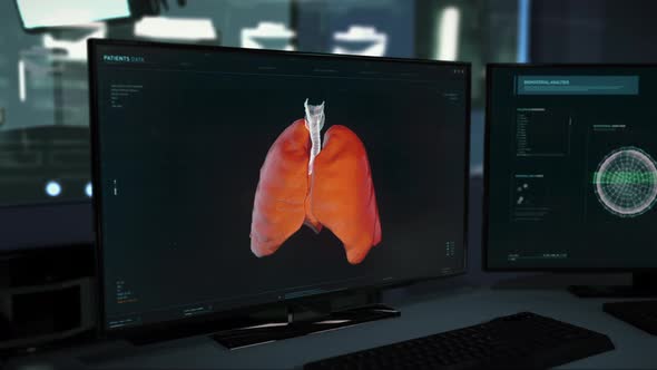 Scanner Diagnosing The Deadly Infection Cells In Patients Lungs At The