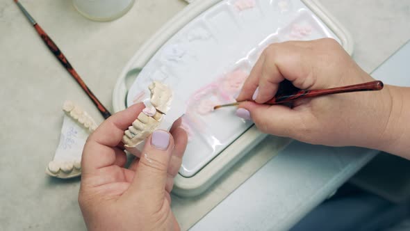 Dental Cast Model is Getting Made By a Doctor alt