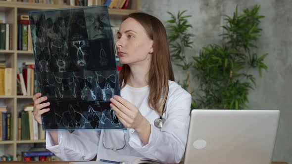 A Young Female Doctor Looks at an Xray While Sitting in an Office in a Clinic alt
