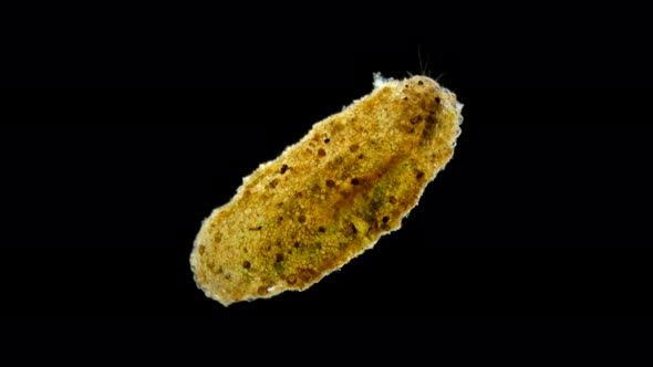 Trichoptera Larvae Under the Microscope alt