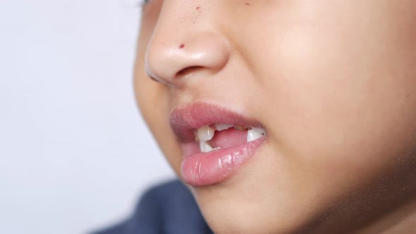 Child Girl Smiling with Deformed Teeth alt