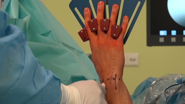Hand And Wrist Surgery