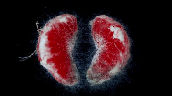 Human Lung Damage Concept Lung Disease Covid 19 Pneumonia Smoker's Lungs alt