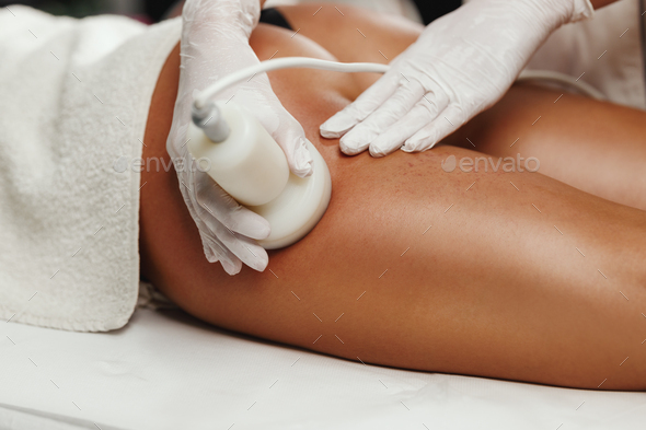 Ultrasound Cavitation Body Contouring Treatment - Stock Photo - Images