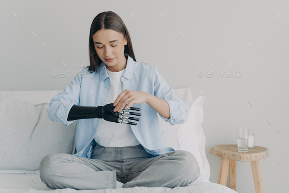 Disabled young woman is setting myoelectric prosthesis prosthesis parameters and functions. - Stock Photo - Images