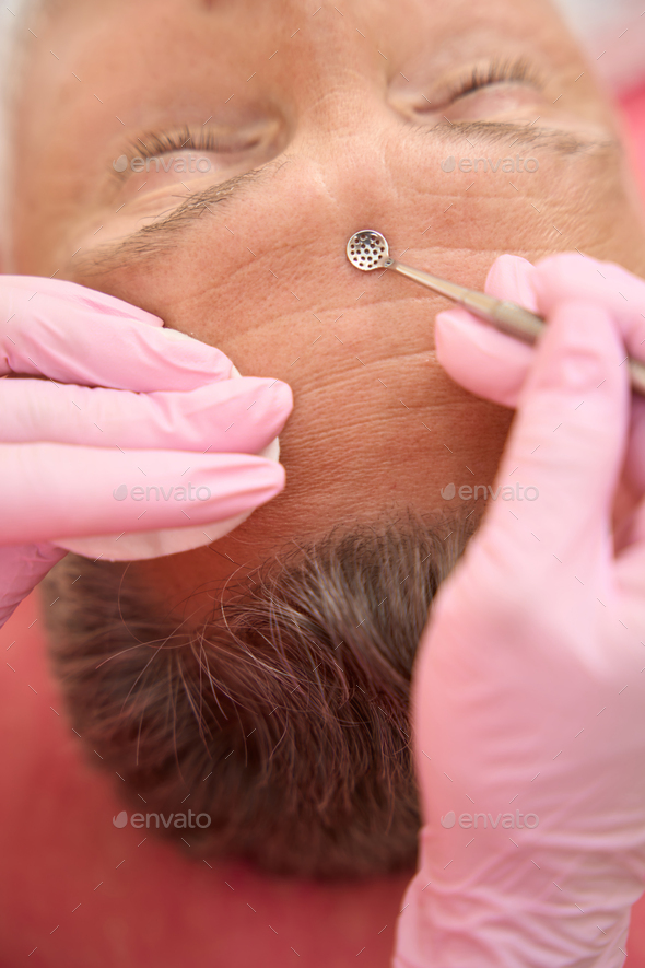 Beautician female hands with uno spoon clean forehead skin - Stock Photo - Images