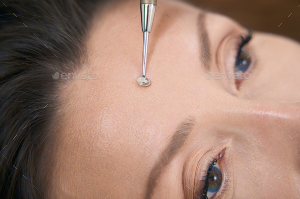 Close up of forehead acne removal with uno spoon - Stock Photo - Images