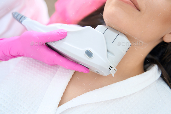 Skin tightening procedure with ultrasonic lifting device