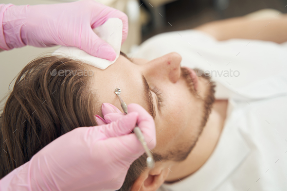 Beauty specialist cleaning pores on forehead with uno spoon - Stock Photo - Images
