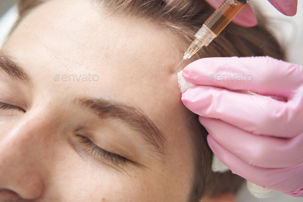 Skin care plasmolifting therapy, performed on male forehead