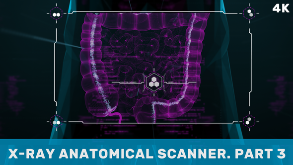X-Ray Anatomical Scanner. Part 3