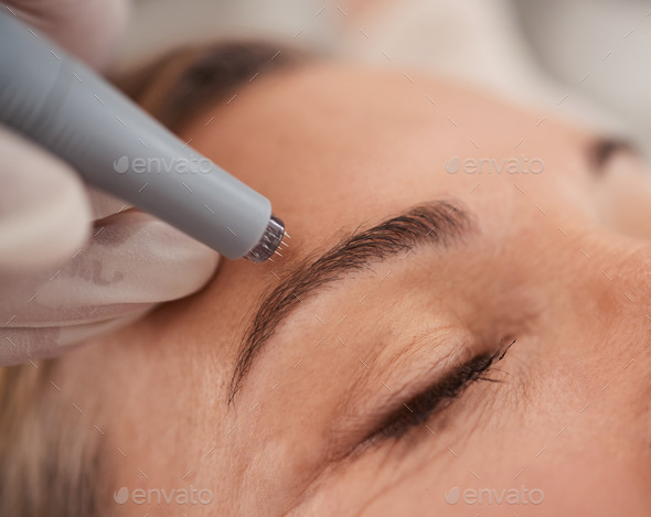 Closeup shot of a mature woman enjoying a micro-needling treatment at a spa