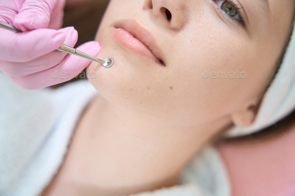Cosmetologist removes pimples with uno spoon on chin of client - Stock Photo - Images