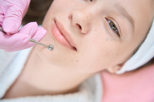 Beautician squeezes pimples with uno spoon on chin of girl - Stock Photo - Images