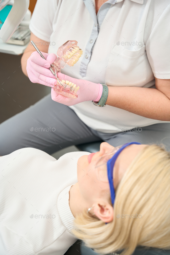 Lady Dentist Showing A Bad Tooth On A Denture Mockup Stock Photo By 