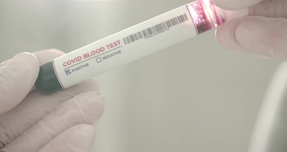Blood Test alt
