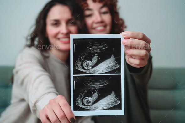Happy gay lesbian couple holding ultrasound photo scan at home - Lgbtq surrogate pregnancy concept
