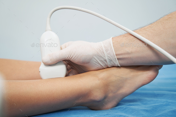 Close up photo of an ultrasound examination of veins in lower limbs