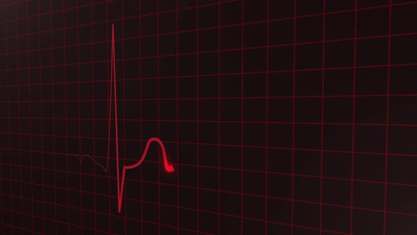 Heartbeat Display Pulse Animation alt