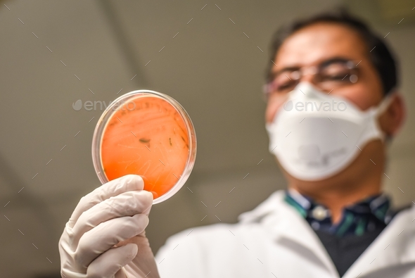 Scientist examining bacterial culture plate in food microbiology laboratory