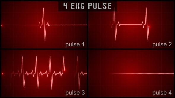 EKG Pulse Display Set