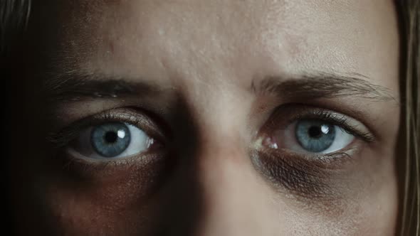 A Sad Beaten Up Woman with Wounds on Face is Looking at Camera alt